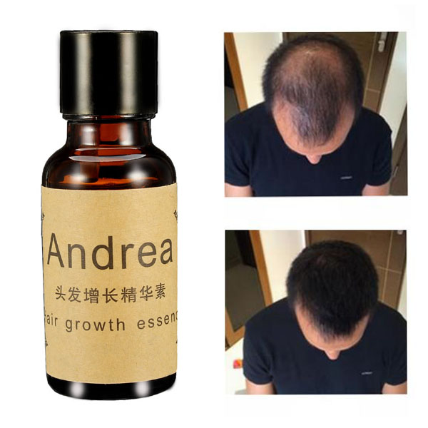 Herbal Hair Growth Essence Liquid Pilatory